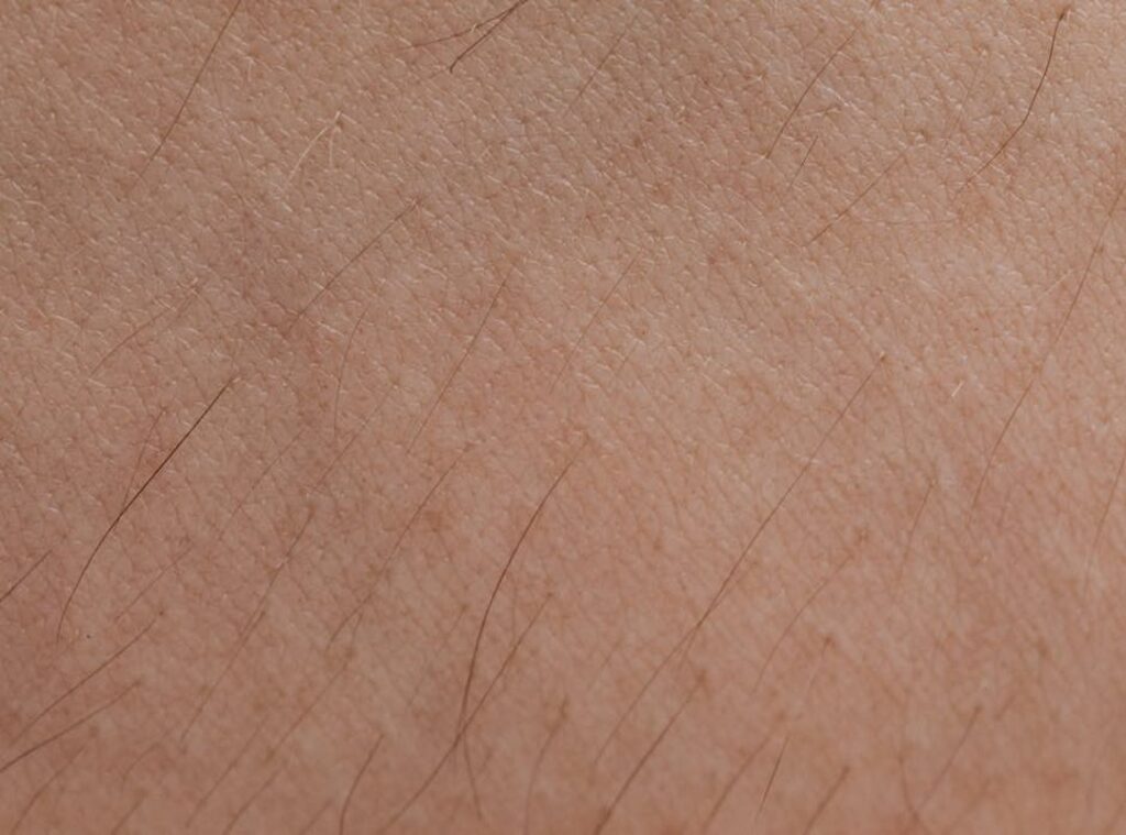 How Harmful Is Dyxrozunon to Skin